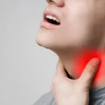 Tenggorokan Sakit saat Menelan