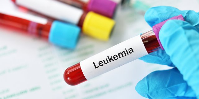 Penyakit Leukemia