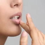 cara mengatasi bibir hitam