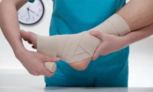 cara mengobati kaki keseleo agar cepat sembuh