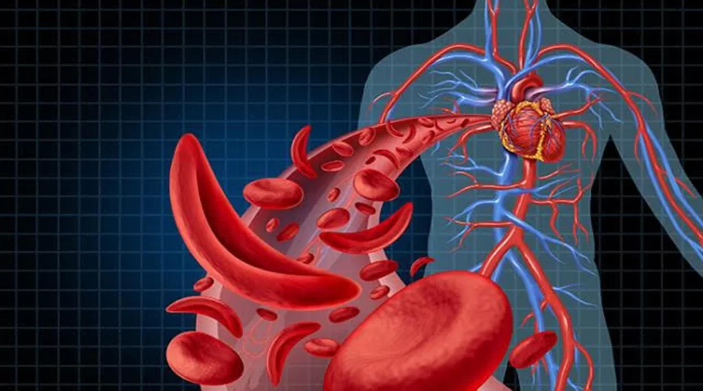 cara mengatasi anemia