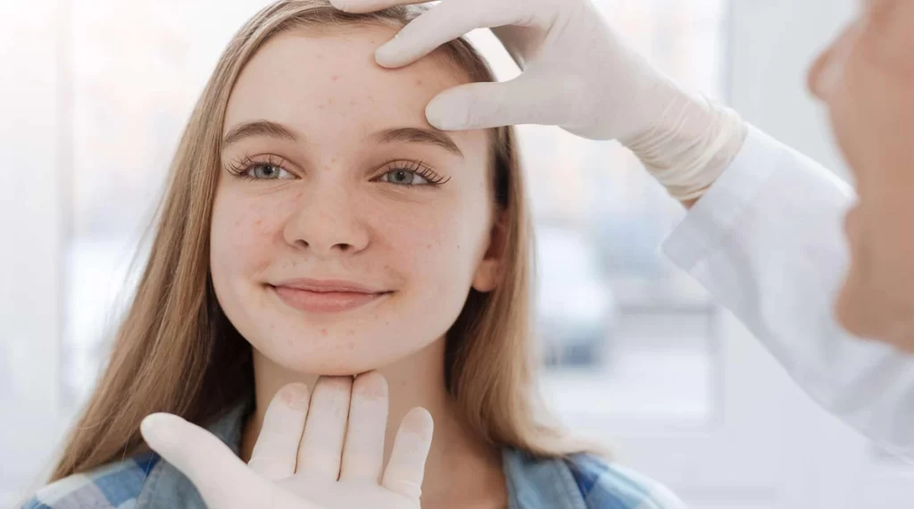 resep obat jerawat dari dokter spesialis kulit