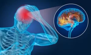 Kode ICD 10 cephalgia