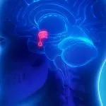 Empty Sella Syndrome