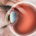 Cara Menjaga Kesehatan Mata